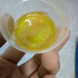 Yến sào ONE NEST cho trẻ biếng ăn
