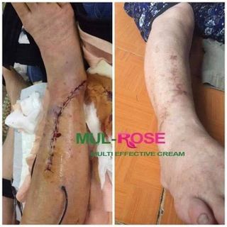 Kem Mulrose