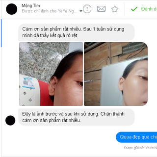 Kem Trắng Da Hàn Quốc