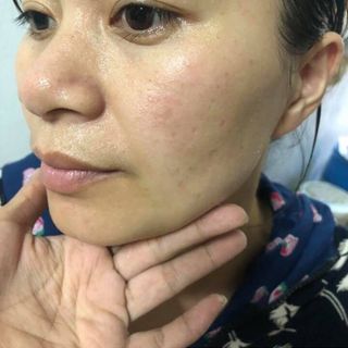 Kem nha nám tan nhan thai chi ol cell