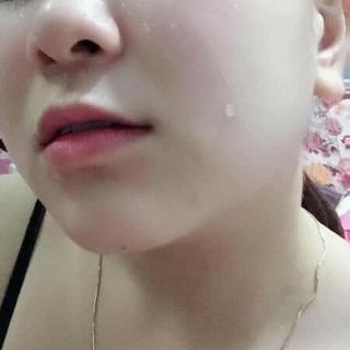 Serum dưỡng da trị ThâmMụnSẹoNám cao cấp BẠCH ĐAB DƯỢC