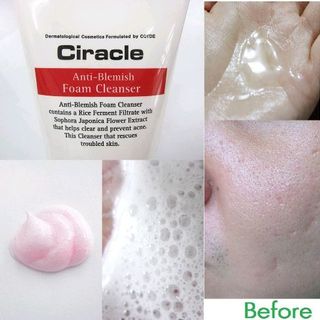 Sữa Rửa Mặt Trị Mụn Ciracle Anti-Blemish Foam Cleanser