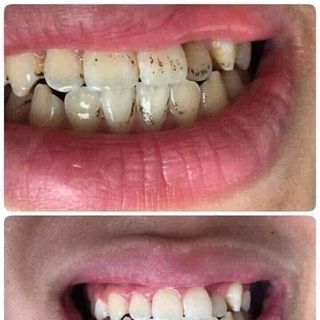 Bột trắng răng T-White