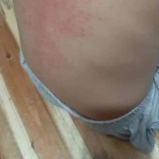 Cao thảo mộc ayofa
