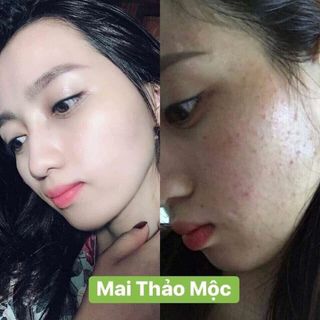 Mai Thảo Mộc
