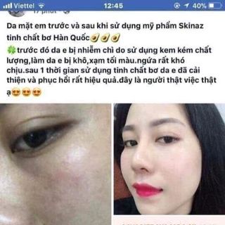 tinh chất bơ