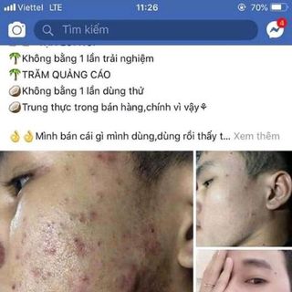 Serum Bạch Đan Dược Trắng mịnsạch thâm mụn