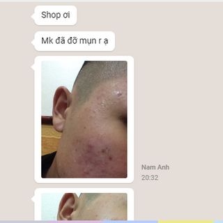 KEM TRỊ MỤN NAM AIA MỸ PHẨM AIA