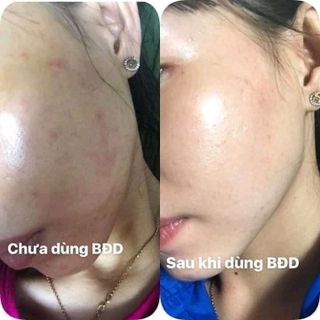 Serum Thần Dược Bạch Đan Dược đặc trị thâm mụn nám cung cấp trấn da giá sỉ