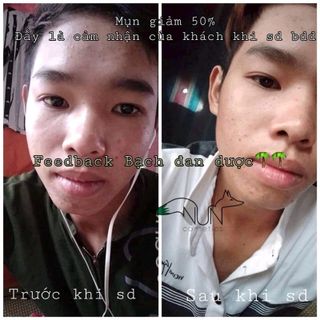 Serum Thần Dược Bạch Đan Dược đặc trị thâm mụn nám cung cấp trấn da