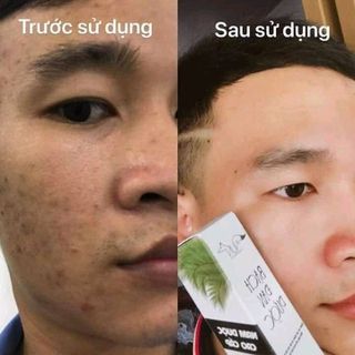 Serum Thần Dược Bạch Đan Dược đặc trị thâm mụn nám cung cấp trấn da