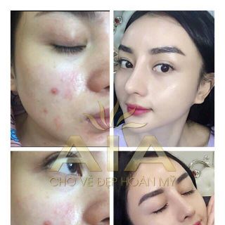 SERUM TRỊ NÁM - TÀN NHANG - THÂM QUẨNG MẮT AIA 30ML MỸ PHẨM AIA