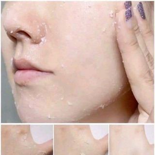 GEN TẨY TẾ BÀO CHẾT