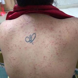 men vi sinh