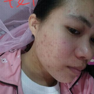 thải độc sủi bọt