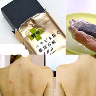 xà phòng trị mụn lưng forblack