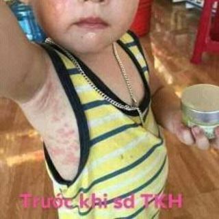 kem dưỡng da thao dược trần kim huyền