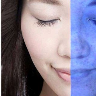 kem trị nám H2