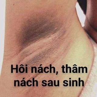 thảo mộc đặc trị hôi nách mồ hôi tay chân