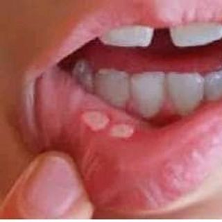 thảo mộc răng miệng