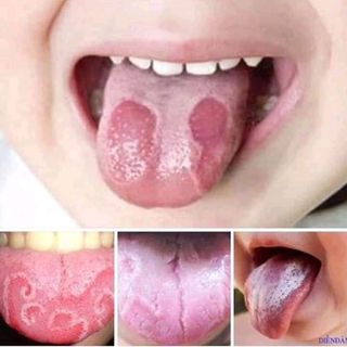 thảo mộc răng miệng