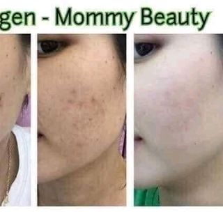 diệp lục collagen