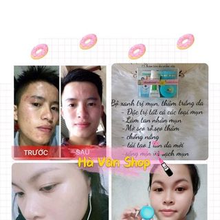 Bộ Đặc Trị Mụn YanHee ThaiLan
