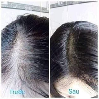 Xịt Bưởi Kích Thích Mọc Tóc-Giảm Rụng tóc-Trị Gàu