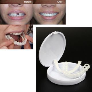 Dụng cụ nẹp răng snapon smile