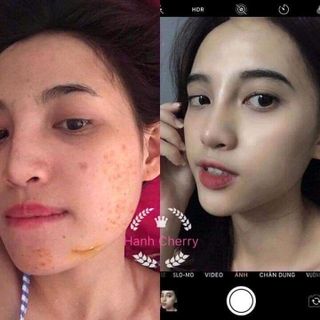 Mai Thảo Mộc Chuẩn Cty 100