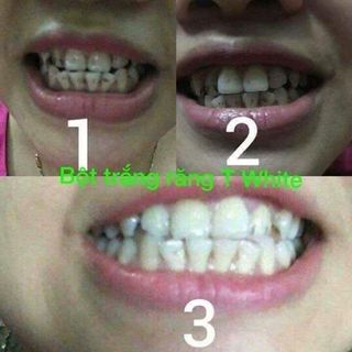 BỘT TRẮNG RĂNG TWHTE làm trắng răng tại nhà