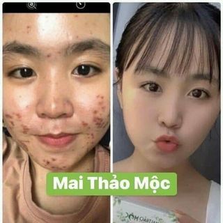 Mai thảo mộc