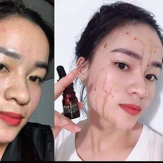Mai thảo mộc
