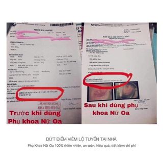 Viên Đặt Phụ Khoa Nữ Oa - ĐÔNG Y VŨ ĐỨC giá sỉ​ giá bán buôn