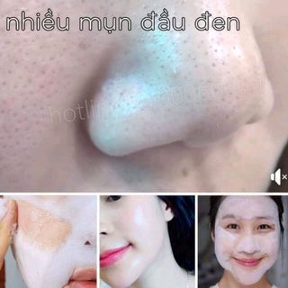 combo detox blanc số 1 13 có bán lẻ