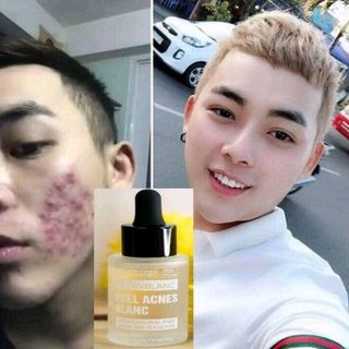 combo detox blanc số 1 13 có bán lẻ