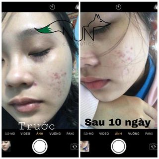 Serum Bạch Đan Dược Cao Cấp Nuncometisc
