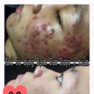 Serum Bạch Đan Dược Cao Cấp Nuncometisc