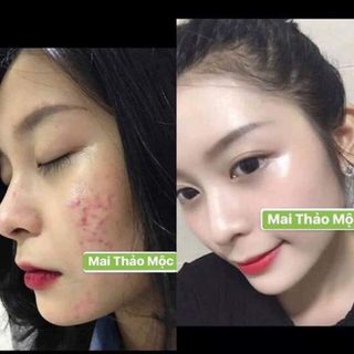 Mai Thảo Mộc