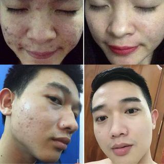 Bột rua mặt thảo mộc hh spa