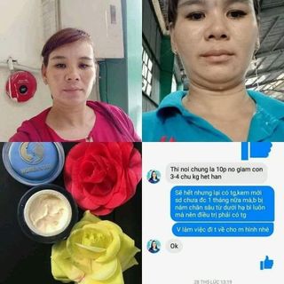 Đặc Trị Nám Hiệu Quả Cao Womens Day Hali Care