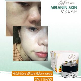 Kem Đặc Trị Nám Tàn Nhang Saffron Nano