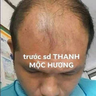 Dầu gội thảo dược TMH