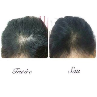 TINH DẦU BƯỞI LÀM MỀM MƯỢT TÓC KÍCH THÍCH MỌC TÓC TẶNG KÈM CHAI XỊT