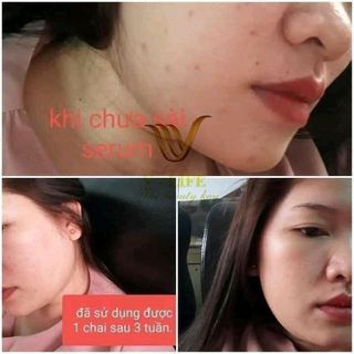 serum ha plus