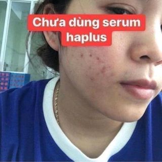 serum ha plus