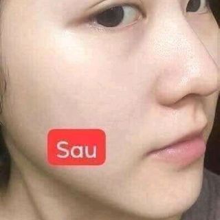 serum ha plus
