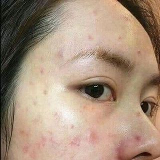 serum ha plus