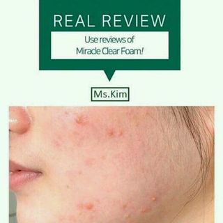 Sữa rửa mặt tạo bọt trị mụn Some By Mi AHA-BHA-PHA 30 Days Miracle Acne