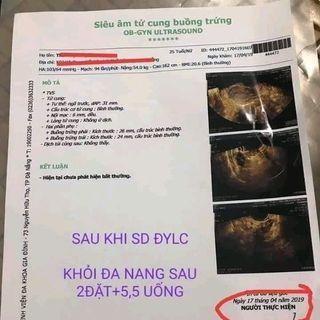 Viên Uống Thảo Mộc Tái Xuân Lan Chi
